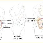 Imunoglobina especifica anti rh