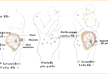 Imunoglobina especifica anti rh