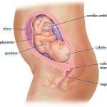 Colo do útero