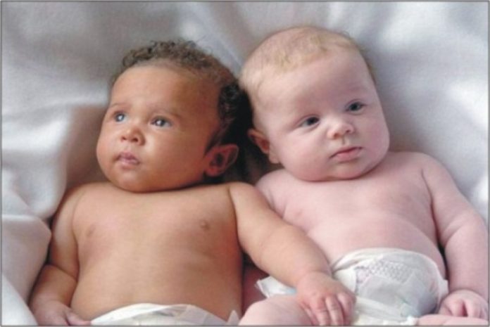 Grávida deu à luz um menino branco e um negroGrávida deu à luz um menino branco e um negro