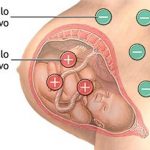 Incompatibilidade sanguínea durante a gravidez