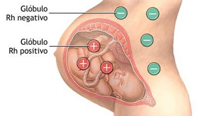 Incompatibilidade sanguínea durante a gravidez