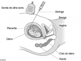 Biopsia da placenta