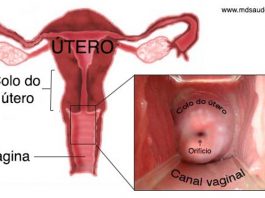 Colo uterino ou colo do útero