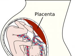 A placenta