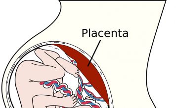 A placenta