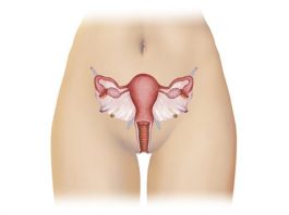 Endometriose, a principal causa da infertilidade feminina